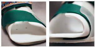 Pictured forefoto ADduction strap