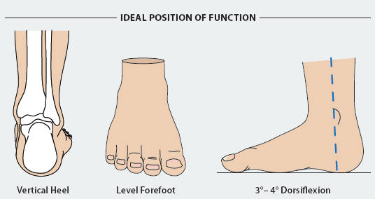 Ideal Position of Function shown as a vertical heel, level forefoot, and 3 degrees of dorsiflexion