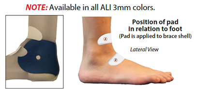 Diagram of a how the supination pad sits against the dorsum and instep