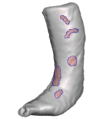 An example of a digital scanning with holes that can be corrected.