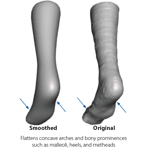 Examples of over-smoothed models where features have been lost.