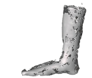 Pictured a scan pocked with holes.