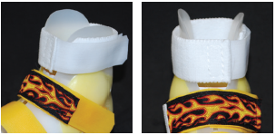 Pictured wraparound anterior posterior strap