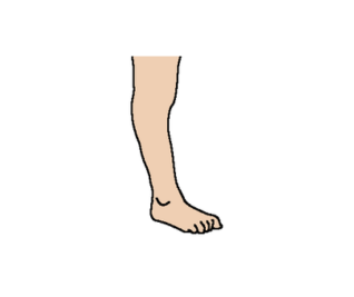 Notable plantarflexion