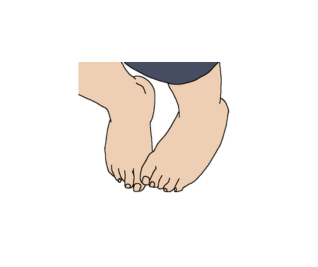 Foot shows mild pronation or supination
