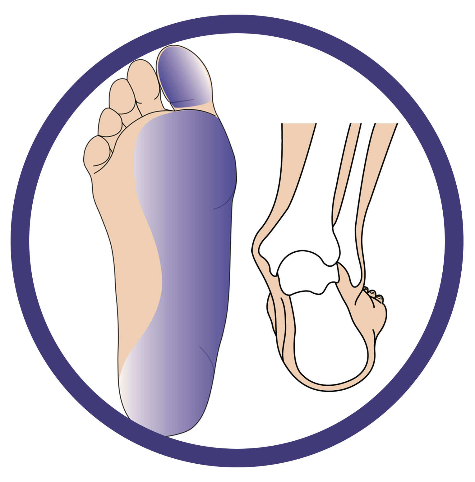 Low Tone Pronation