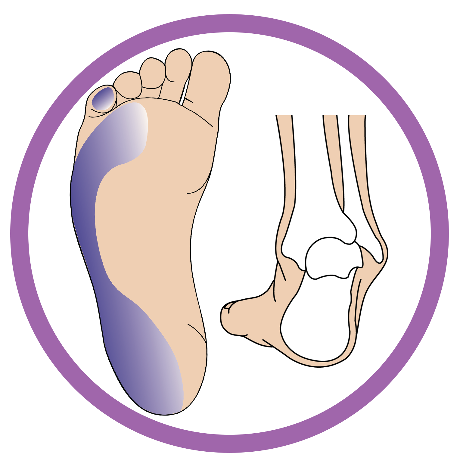 High Tone Pronation