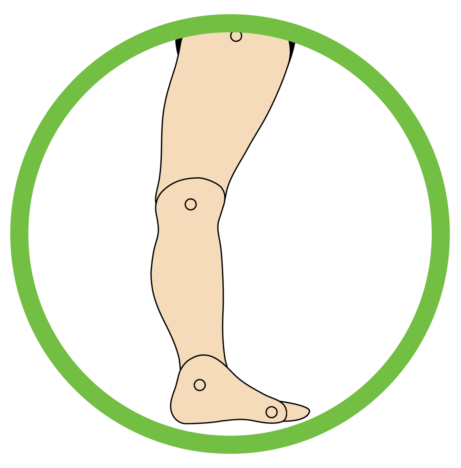 This image showcases the structure of the foot that is suffering from Knee Hyperextension