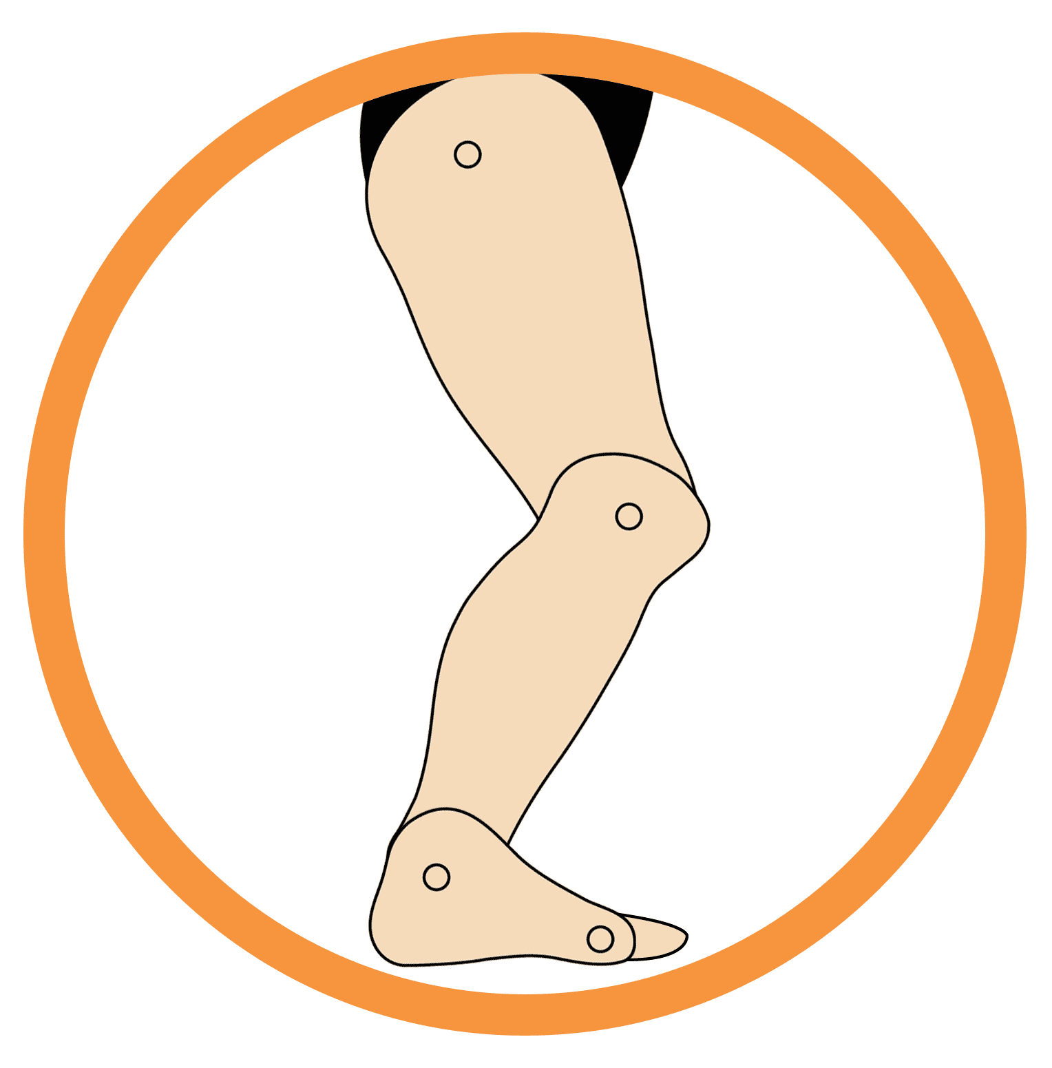 This image showcases structure of the foot that is suffering from Excess Dorsiflexion