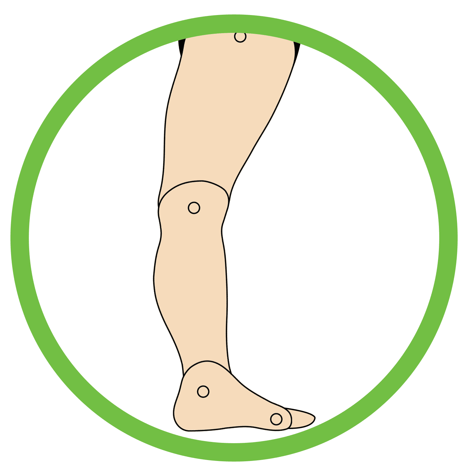 This image showcases the structure of the foot that is suffering from Knee Hyperextension